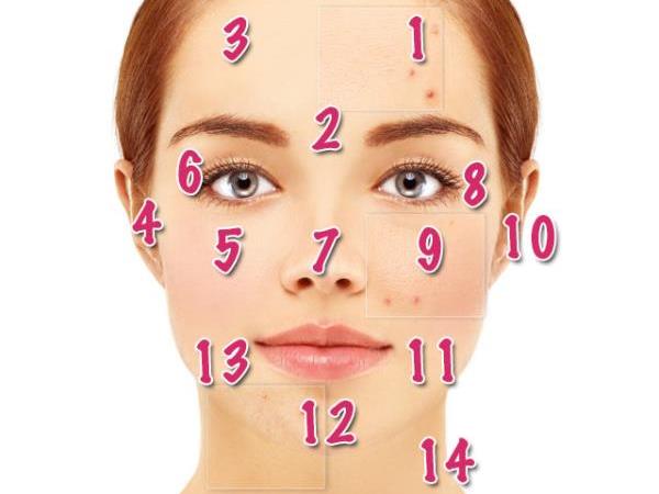 What do acne and pimples on the face say about your health?