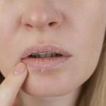 Dry Mouth: Thirst Sign or Warning of a Bigger Issue?