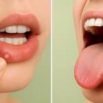 How to recognize that you are lacking folic acid