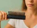 Sugar, Salt, and Pasta: The Everyday Foods That May Be Quietly Undermining Your Hair