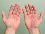Your Hands Know More Than You Think: What Swelling, Cracked Skin and Achy Fingers Are Really Trying to Tell You