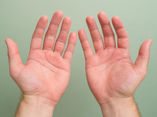 Your Hands Know More Than You Think: What Swelling, Cracked Skin and Achy Fingers Are Really Trying to Tell You