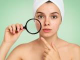 Vitamin B12 and Acne: The Hidden Link Your Skin Has Known All Along