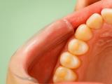 Why Good Hygiene Doesn't Always Protect Your Teeth – and What Diet Can Really Do